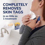 Load image into Gallery viewer, Dr. Scholl&#39;s Freeze Away Skin TAG Remover, 8 ct // Removes Skin Tags in As Little As 1 Treatment, FDA-Cleared, Clinically Proven, 8 Treatments
